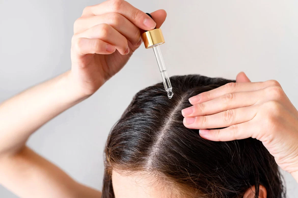 What Is The Best Natural Scalp Treatment?